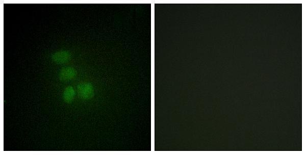 Immunofluorescence analysis of HepG2 cells, using hnRNP G Antibody
