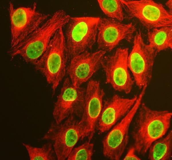 a04740 2 nkx2 2 primary antibodies if testing 1