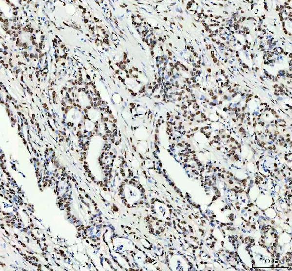 IHC analysis of NKX2-2 using anti-NKX2-2 antibody (A04740-2)