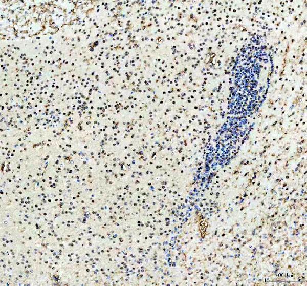 IHC analysis of NKX2-2 using anti-NKX2-2 antibody (A04740-2)