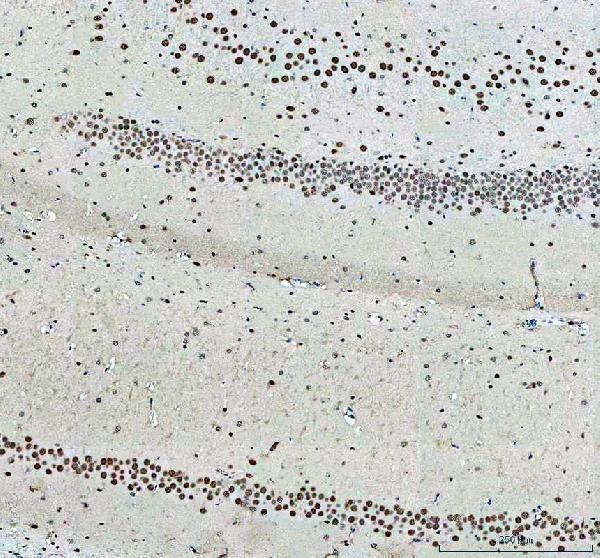 IHC analysis of NKX2-2 using anti-NKX2-2 antibody (A04740-2)