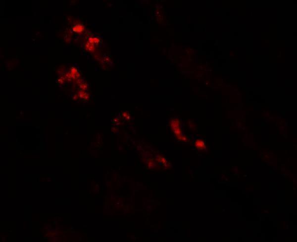 a04740 nkx2 2 primary antibodies if testing 3