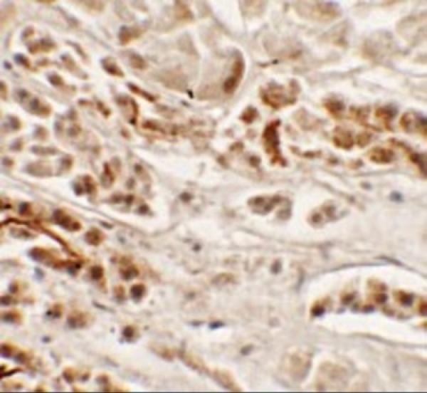 a04740 nkx2 2 primary antibodies ihc testing 2