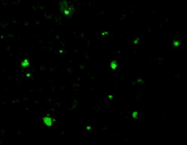 a04743 acin1 primary antibodies if testing 3