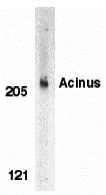 a04743 acin1 primary antibodies wb testing 1