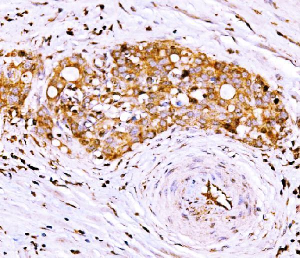 a04744 1 agpat2 primary antibodies ihc testing 2