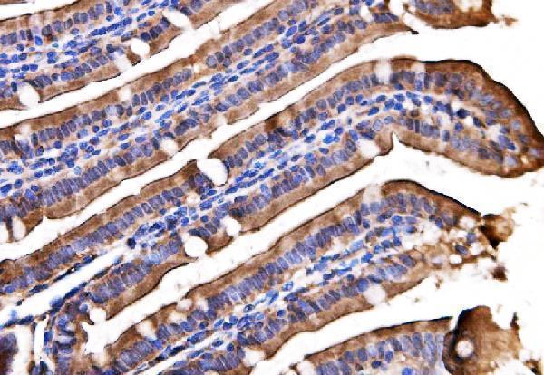 a04744 1 agpat2 primary antibodies ihc testing 3
