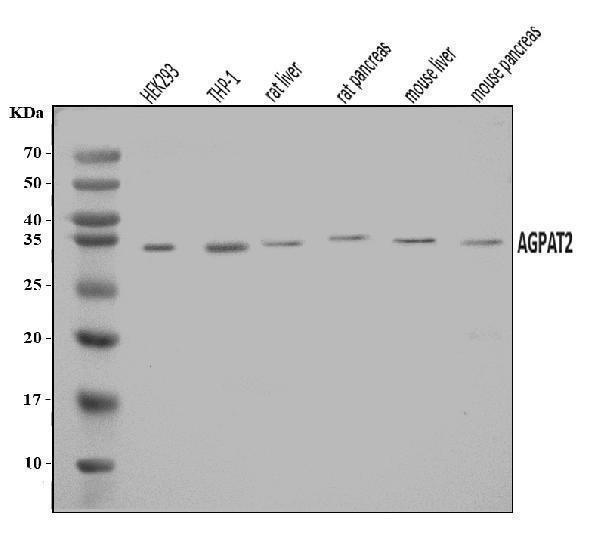 a04744 1 agpat2 primary antibodies wb testing 1