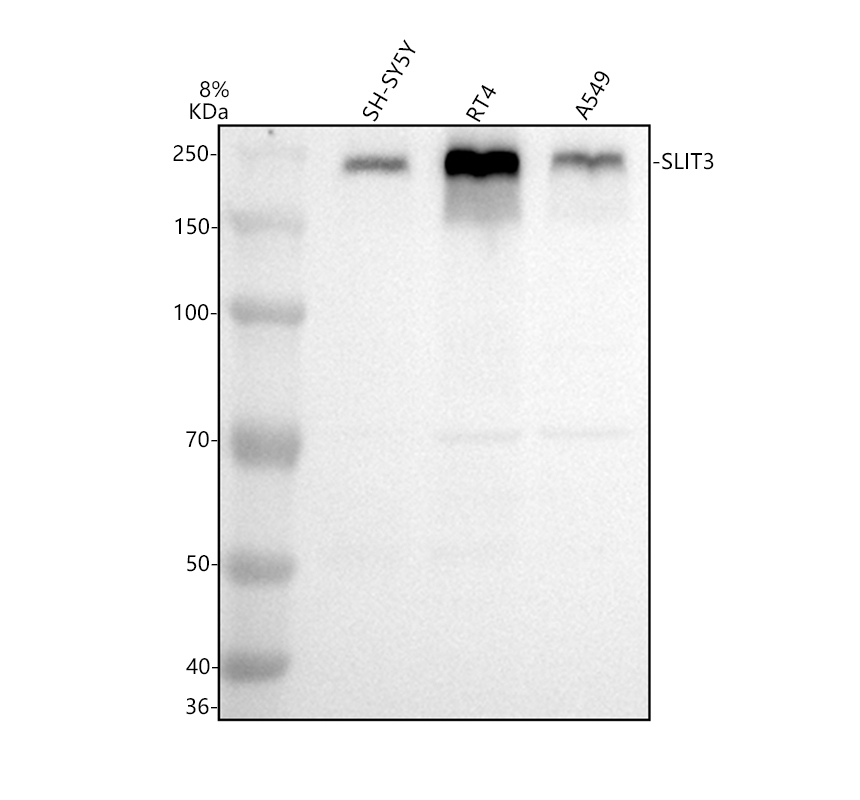 a04745 2 slit3 primary antibodies wb testing 1