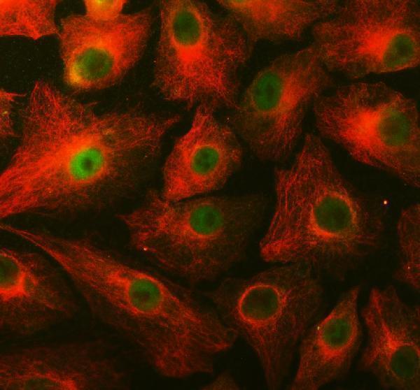IF analysis of SLC25A12 using anti-SLC25A12 antibody (A04746-3) and anti-Alpha Tubulin antibody (M03989-3)