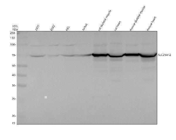 Western blot analysis of SLC25A12 using anti-SLC25A12 antibody (A04746-3)