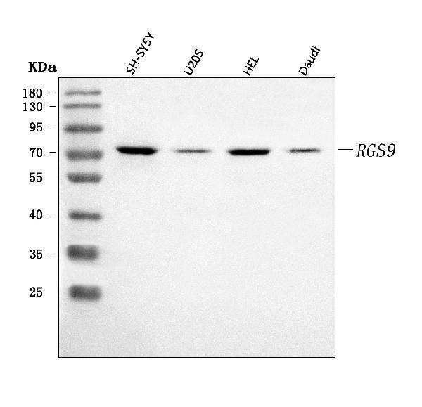  Western blot analysis of RGS9 using anti-RGS9 antibody (A04748-1)