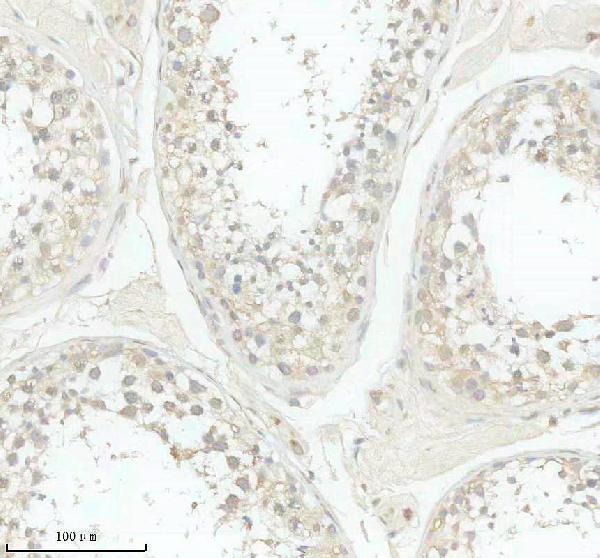 IHC analysis of SLC29A3 using anti-SLC29A3 antibody (A04749-1)