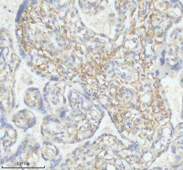 IHC analysis of SLC29A3 using anti-SLC29A3 antibody (A04749-1)