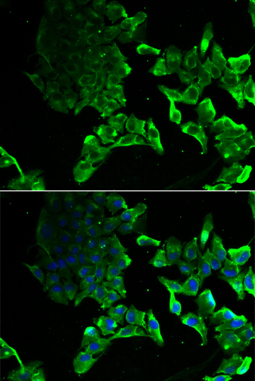 Immunofluorescence analysis of MCF-7 cell using SCYL1 antibody