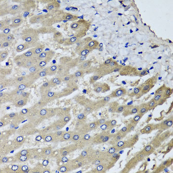 Immunohistochemistry of paraffin-embedded human liver injury using SCYL1 antibody at dilution of 1:100 (x40 lens)