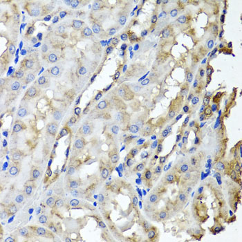 Immunohistochemistry of paraffin-embedded rat kidney using SCYL1 antibody at dilution of 1:100 (x40 lens)