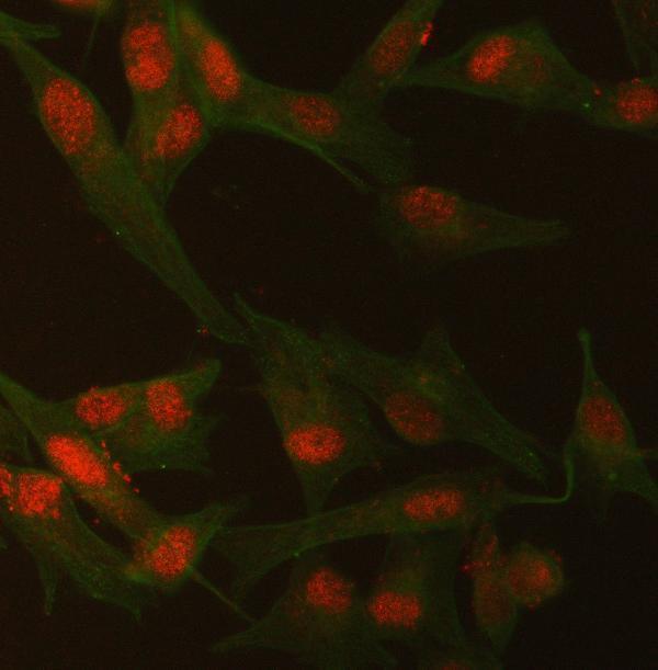  IF analysis of SMCHD1 and Tubulin beta using anti-SMCHD1 antibody (A04514-2) and anti-Tubulin beta antibody (M05613-4)