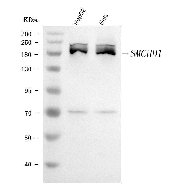  Western blot analysis of SMCHD1 using anti-SMCHD1 antibody (A04751-1)