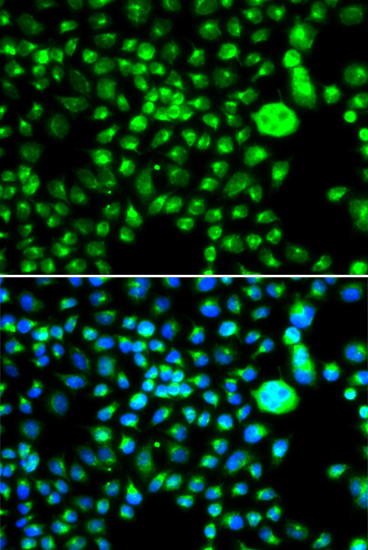 a04751 smchd1 primary antiboties if testing 2