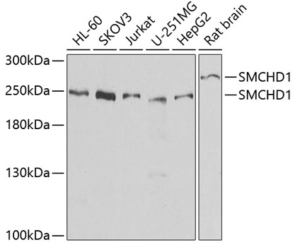 a04751 smchd1 primary antiboties wb testing 1