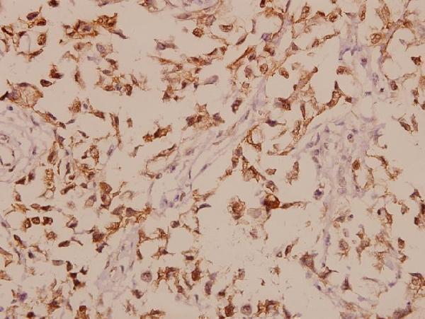 a04752 1 gabrb1 primary antiboties ihc testing 2