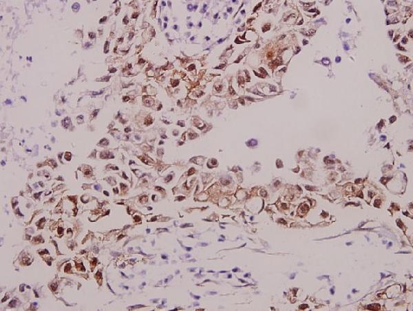 a04752s434 gabrb1 primary antiboties ihc testing 2