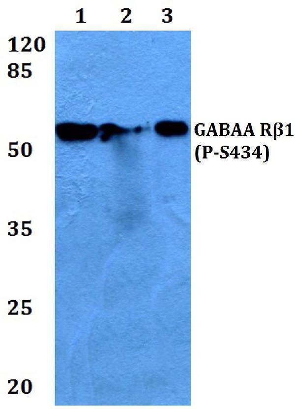 a04752s434 gabrb1 primary antiboties wb testing 1