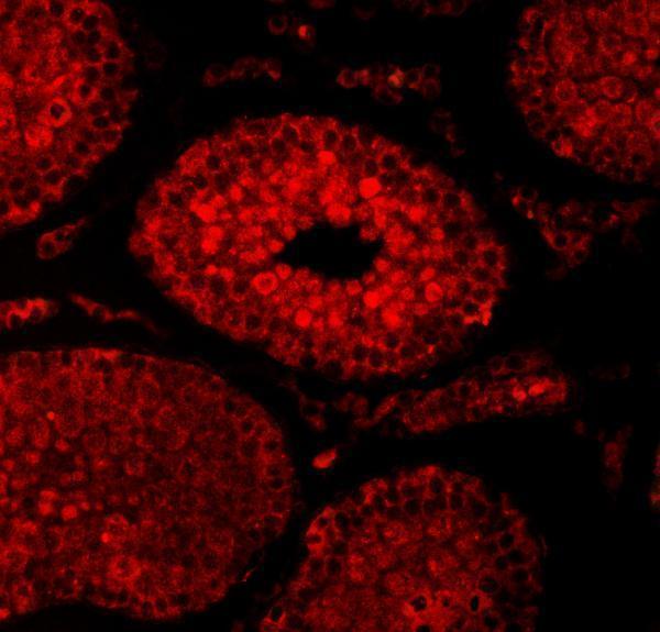 a04753 3 sae1 primary antibodies if testing 12