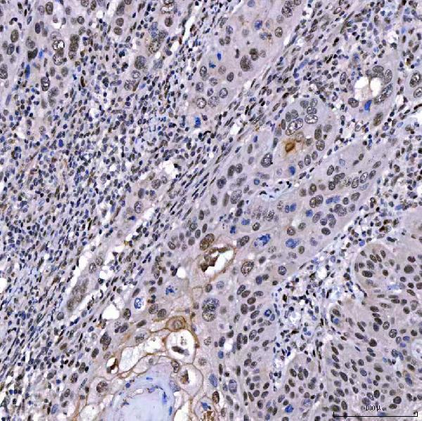  IHC analysis of SAE1 using anti-SAE1 antibody (A04753-3)