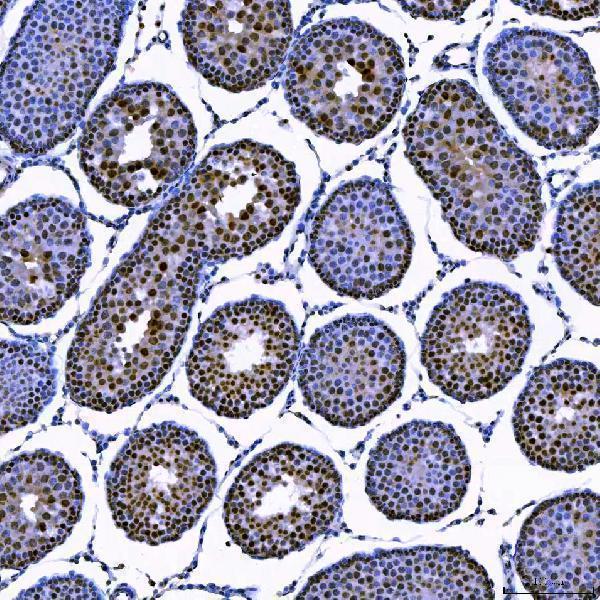 a04753 3 sae1 primary antibodies ihc testing 5