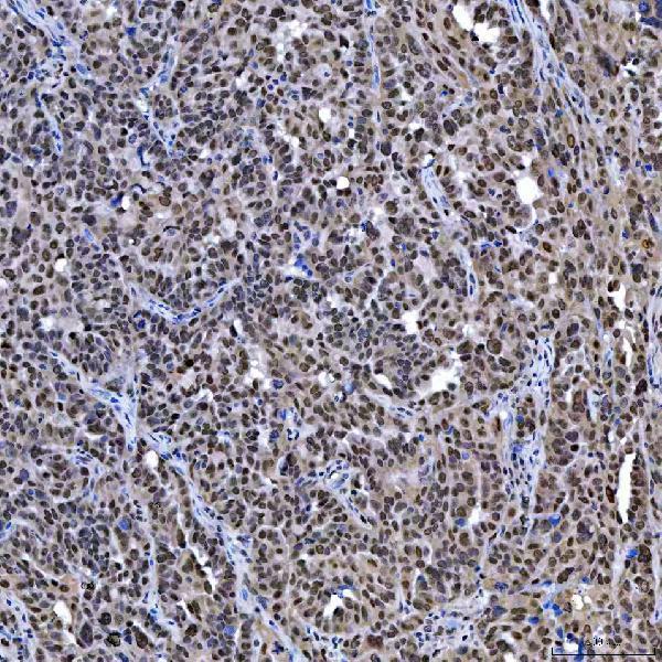 a04753 3 sae1 primary antibodies ihc testing 7