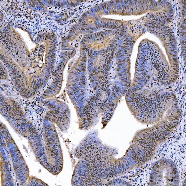 a04753 3 sae1 primary antibodies ihc testing 8