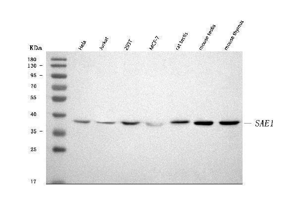  Western blot analysis of SAE1 using anti-SAE1 antibody (A04753-3)