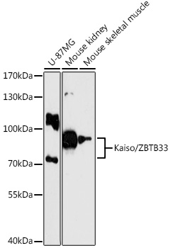 a04754 zbtb33 primary antiboties wb testing 1