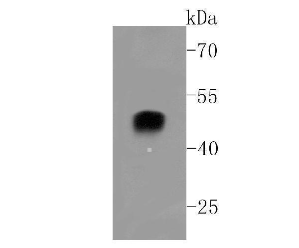 Western blot analysis of alpha sarcoglycan on rat heart cells lysates using anti-alpha sarcoglycan antibody at 1/500 dilution