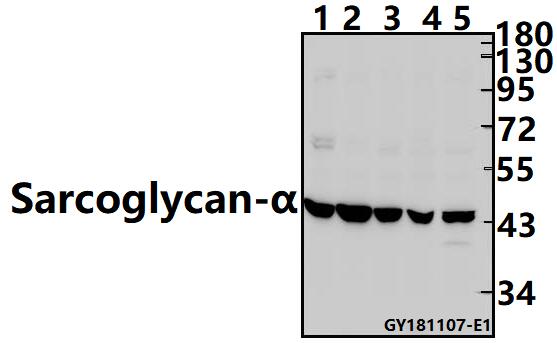 Western blot (WB) analysis of Sarcoglycan-α pAb at 1:500 dilution
Lane1:AML-12 whole cell lysate(40ug)
Lane2:H9C2 whole cell lysate(40ug)
Lane3:A549 whole cell lysate(40ug)
Lane4:EC9706 whole cell lysate(40ug)
Lane5:H1792 whole cell lysate(40ug)