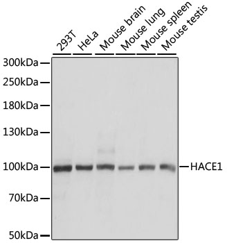 Western blot analysis of extracts of various cell lines, using HACE1 antibody  at 1:1000 dilution