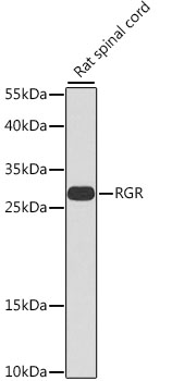 a04759 1 rgr primary antiboties wb testing 1