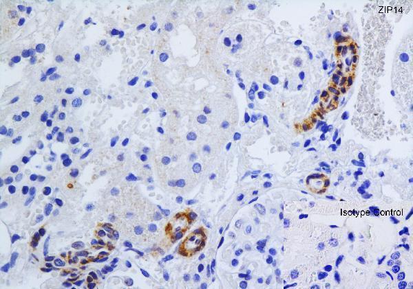 a04761 slc39a14 primary antibodies ihc testing 4