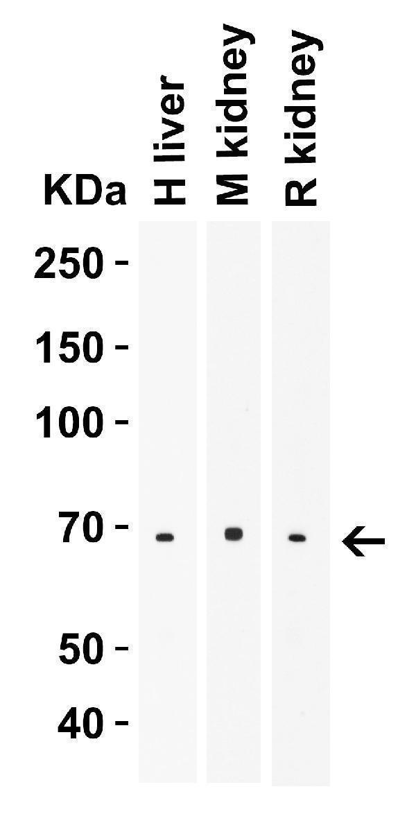  WB Validation  in Human, Mouse and Rat Tissues
Loading: 10 μg of lysate 
Antibodies:  ZIP14, A04761, 2 μ g/mL , 1 h incubation at RT in 5% NFDM/TBST
