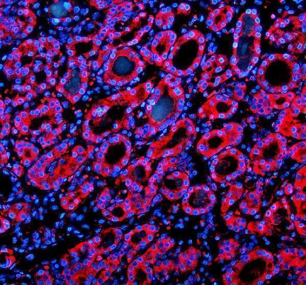 a04766 1 sil1 primary antibodies if testing 1