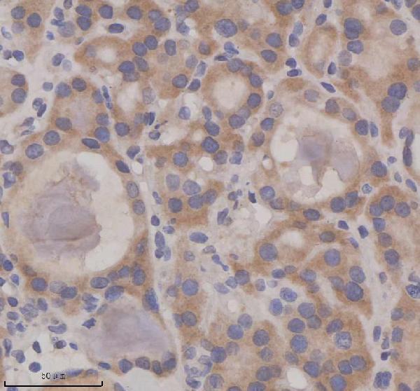 IHC analysis of SIL1 using anti-SIL1 antibody (A04766-1)