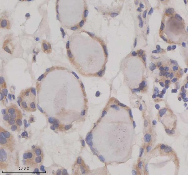 IHC analysis of SIL1 using anti-SIL1 antibody (A04766-1)