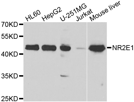 Western blot analysis of extracts of various cell lines, using NR2E1 antibody