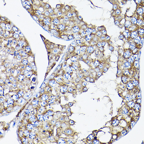 a04768 ramp2 primary antiboties ihc testing 4