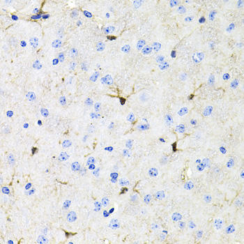 Immunohistochemistry of paraffin-embedded mouse brain using ACVR2A antibody  at dilution of 1:100 
