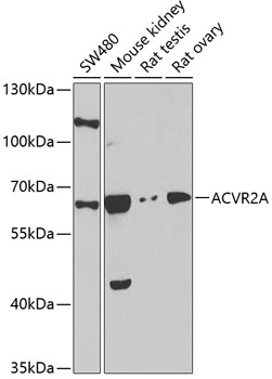 Western blot analysis of extracts of A-431 cells, using ACVR2A antibody  at 1:500 dilution