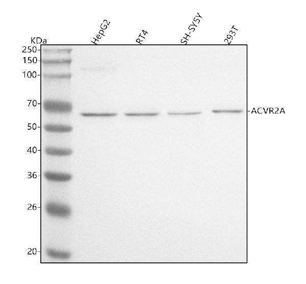  Western blot analysis of ACVR2A using anti-ACVR2A antibody (A04770-2)