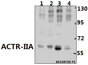 Western blot (WB) analysis of ACTR-IIA (H59) pAb at 1:500 dilution
Lane1:AML-12 whole cell lysate(40ug)
Lane2:C6 whole cell lysate(40ug)
Lane3:HEK293T whole cell lysate(40ug)
Lane4:A549 whole cell lysate(40ug)